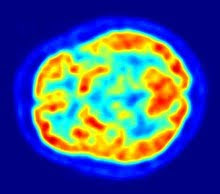 Mapping Out the Brain: PET Scans and the Structure of the Brain