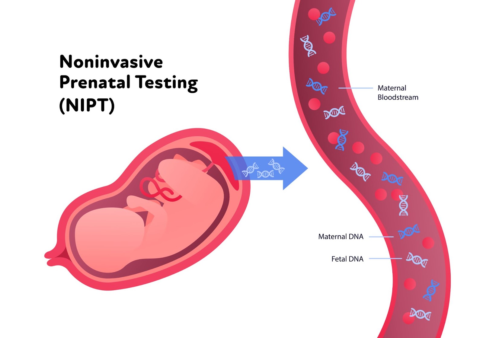 NIPT: The Prenatal Game-Changer