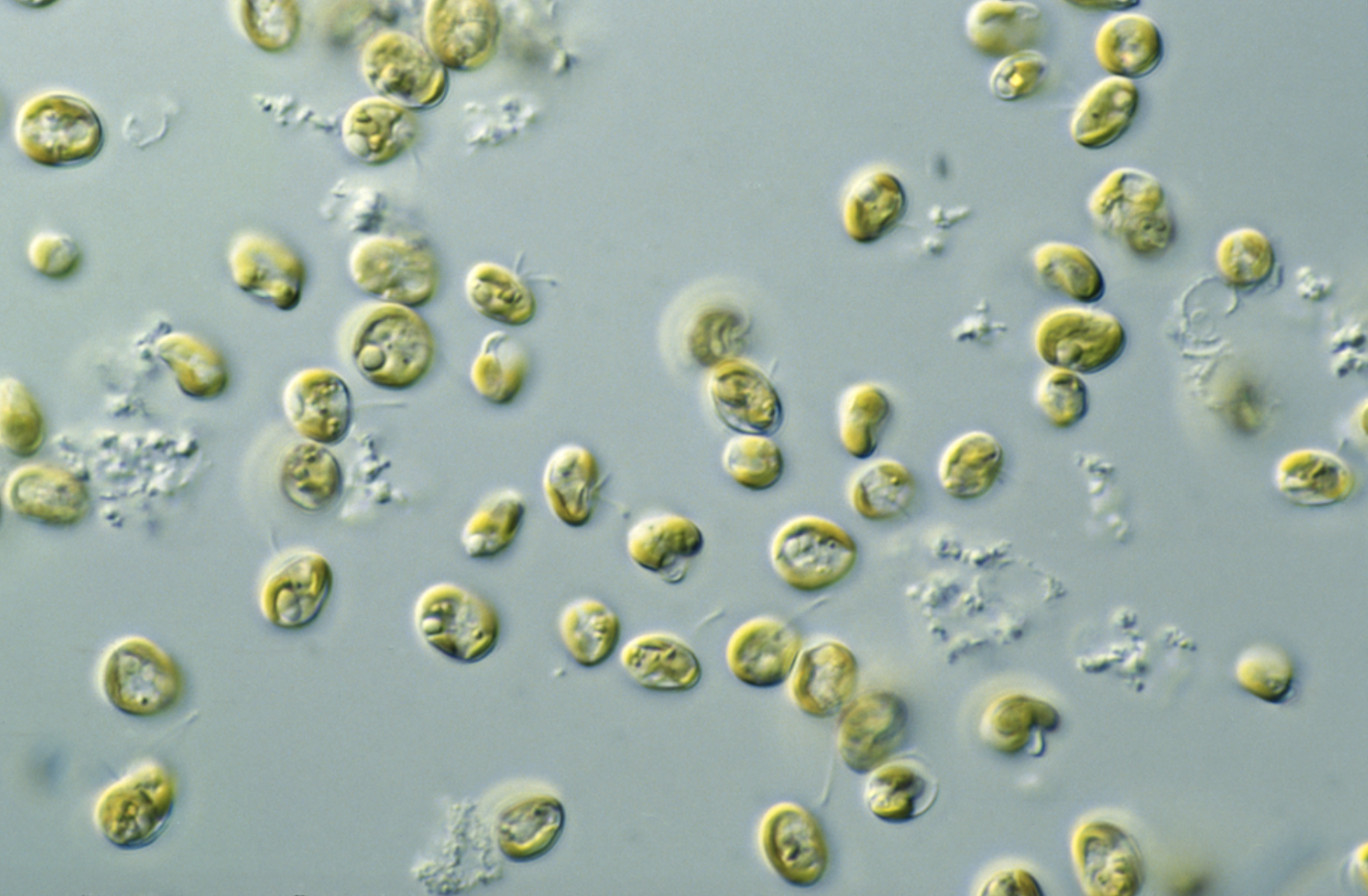 Blooming with Possibility: Microalgae as a Biofuel Feedstock